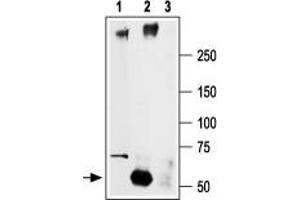Immunoprecipitation of rat brain lysate: - 1. (SCN2A Antikörper  (Intracellular))