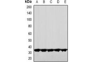 Western blot analysis of CNOT7 expression in HeLa (A), HuvEc (B), DKD (C), mouse brain (D), rat brain (E) whole cell lysates. (CNOT7 Antikörper  (N-Term))