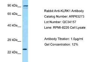 Western Blotting (WB) image for anti-Killer Cell Lectin-Like Receptor Subfamily K, Member 1 (KLRK1) (C-Term) antibody (ABIN2789431) (KLRK1 Antikörper  (C-Term))