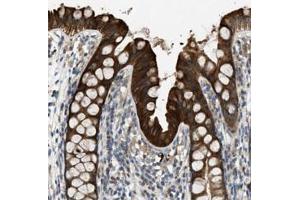 Immunohistochemical staining of human rectum shows strong cytoplasmic positivity in glandular cells.