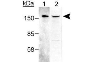 Western blot analysis of RAD50 in 25 ng purified hMre11-hRAD50 complex (Lane 1) and 25 ug crude HeLa extract (Lane 2 :) with RAD50 polyclonal antibody .