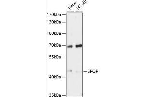 Western blot analysis of extracts of various cell lines, using SPOP antibody (ABIN6130702, ABIN6148373, ABIN6148375 and ABIN6215681) at 1:3000 dilution. (SPOP-B Antikörper  (AA 175-374))