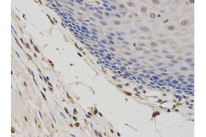 Immunohistochemistry (IHC) image for anti-Second Mitochondria-Derived Activator of Caspase (DIABLO) antibody (ABIN1872269)