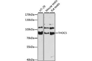 Western blot analysis of extracts of various cell lines, using THOC5 antibody (ABIN6128826, ABIN6149119, ABIN6149120 and ABIN6215328) at 1:3000 dilution. (THO Complex 5 Antikörper  (AA 150-370))