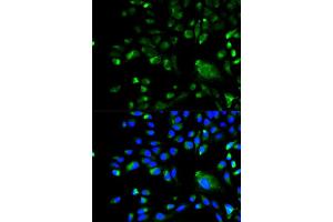 Immunofluorescence analysis of A549 cell using BCL10 antibody. (BCL10 Antikörper)
