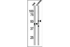 Western blot analysis of anti-PSKH1 Antibody (N-term) in Hela cell line lysate and mouse kidney tissue lysate (35ug/lane). (PSKH1 Antikörper  (N-Term))