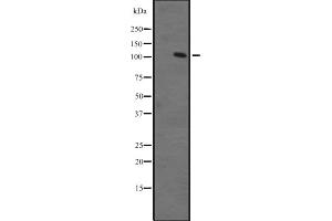 Western blot analysis of ZFPM1 expression in Ant fetal muscle lysate ;,The lane on the left is treated with the antigen-specific peptide. (ZFPM1 Antikörper  (Internal Region))