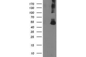 Image no. 1 for anti-Coronin, Actin Binding Protein, 1A (CORO1A) antibody (ABIN1497574) (Coronin 1a Antikörper)