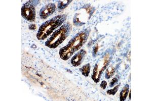 Anti-NKCC1 antibody, IHC(F) IHC(F): Rat Intestine Tissue (SLC12A2 Antikörper  (N-Term))