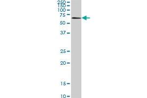 AKT3 monoclonal antibody (M07), clone 6F12. (AKT3 Antikörper  (AA 100-189))
