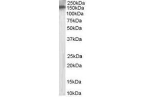 Image no. 1 for anti-Receptor Protein Tyrosine Phosphatase (PTPRT) (Internal Region) antibody (ABIN374470) (PTPRT Antikörper  (Internal Region))