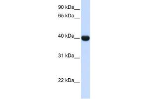 ADH1A antibody used at 1 ug/ml to detect target protein. (ADH1A Antikörper)