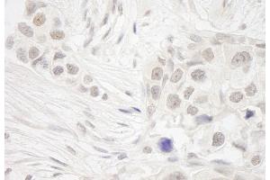 anti-NSL1, MIND Kinetochore Complex Component, Homolog (NSL1) (AA 150-200) antibody