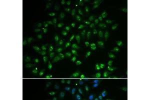 Immunofluorescence analysis of A549 cells using HAND2 Polyclonal Antibody (HAND2 Antikörper)
