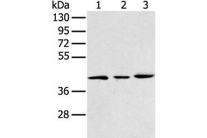 Western blot analysis of 293T K562 and Raji cell using DCX Polyclonal Antibody at dilution of 1:400 (Doublecortin Antikörper)