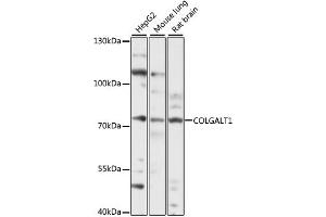 Western blot analysis of extracts of various cell lines, using COLG antibody (ABIN7267480) at 1:1000 dilution. (GLT25D1 Antikörper  (AA 30-230))