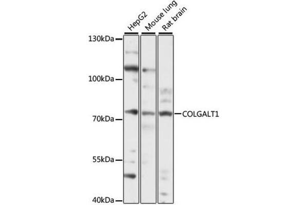 GLT25D1 Antikörper  (AA 30-230)