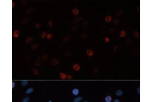 Immunofluorescence analysis of HeLa cells using DNMT3B Polyclonal Antibody at dilution of 1:100. (DNMT3B Antikörper)