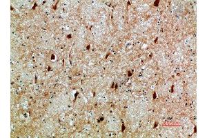 Immunohistochemical analysis of paraffin-embedded human-brain, antibody was diluted at 1:200 (NFAT5 Antikörper  (AA 1268-1341))