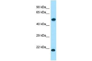 WB Suggested Anti-ALG10B Antibody Titration: 1. (ALG10B Antikörper  (N-Term))