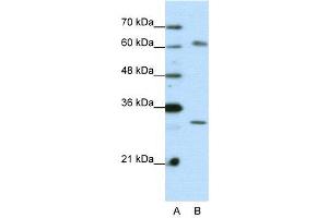 WB Suggested Anti-AUH  Antibody Titration: 0.