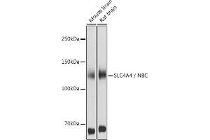 Western blot analysis of extracts of various cell lines, using SLC4 / NBC antibody (ABIN6129130, ABIN6148013, ABIN6148014 and ABIN6220962) at 1:1000 dilution. (SLC4A4 Antikörper  (AA 1-240))