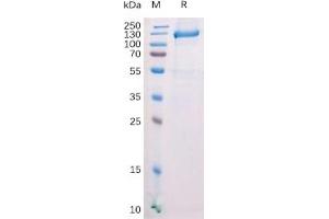 Mouse FAP Protein, N-mFc Tag on SDS-PAGE under reducing condition. (FAP Protein (mFc Tag))