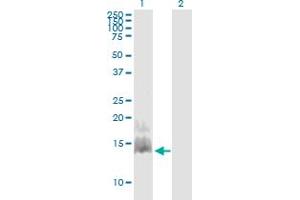 Western Blot analysis of CCL28 expression in transfected 293T cell line by CCL28 monoclonal antibody (M03), clone 3A7. (CCL28 Antikörper  (AA 24-127))