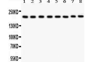 Anti- TJP1 antibody, Western blotting All lanes: Anti TJP1  at 0. (TJP1 Antikörper  (AA 1178-1527))
