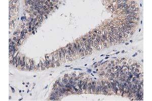 Image no. 7 for anti-Acyl-CoA Thioesterase 12 (ACOT12) antibody (ABIN1496414) (ACOT12 Antikörper)