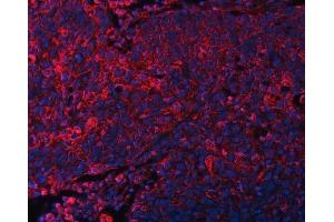 IF analysis of DOCK180/DOCK1 using anti-DOCK180/DOCK1 antibody (ABIN7599615). (DOCK1 Antikörper  (AA 100-1732))