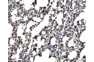 IHC analysis of SPHK1 using anti-SPHK1 antibody (ABIN7600168). (SPHK1 Antikörper  (AA 16-267))