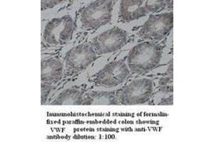 Image no. 1 for anti-Von Willebrand Factor (VWF) (Internal Region) antibody (ABIN791020) (VWF Antikörper  (Internal Region))