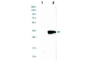 Western blot analysis of Lane 1: Negative control (vector only transfected HEK293T lysate), Lane 2: Over-expression Lysate (Co-expressed with a C-terminal myc-DDK tag (~3. (Tropomyosin Antikörper  (AA 128-243))
