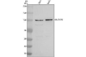 Western blot analysis of GUCY2D using anti-GUCY2D antibody (ABIN7825435).