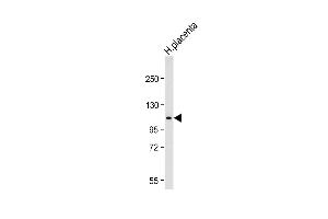 Western blot analysis of lysate from Jurkat cell line, using G Antibody (N-term) (ABIN656475 and ABIN2845755). (GAA Antikörper  (N-Term))