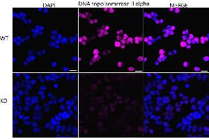 Immunocytochemical staining of HeLa cells using DNA topoisomerase II alpha antibody (ABIN7800574), 1:1,000), Top panel: wild-type (WT), Bottom panal: DNA topoisomerase II alpha shRNA knockdown (KD). (Rekombinanter Topoisomerase II alpha Antikörper)