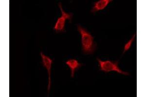 ABIN6276161 staining Hela by IF/ICC. (OR51A2 Antikörper  (Internal Region))