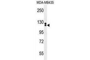 TTLL13 Antibody (Center) western blot analysis in MDA-MB435 cell line lysates (35 µg/lane). (TTLL13 Antikörper  (Middle Region))