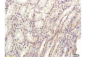 Formalin-fixed and paraffin embedded: human stomach tissue labeled with Anti-GLP-2 Polyclonal Antibody, Unconjugated (ABIN726305) at 1:200, followed by conjugation to the secondary antibody and DAB staining (GLP-2 Antikörper  (AA 146-165))