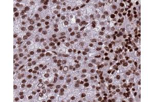 Histone H3 Antibody for IHC in human testis (Histone 3 Antikörper)