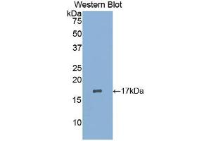 Western blot analysis of the recombinant protein. (LIFR Antikörper  (AA 45-184))