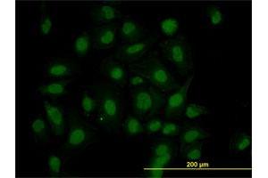 Immunofluorescence of monoclonal antibody to HIPK1 on HeLa cell. (HIPK1 Antikörper  (AA 330-430))