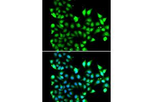 Immunofluorescence analysis of MCF7 cell using SNRPD2 antibody. (SNRPD2 Antikörper)