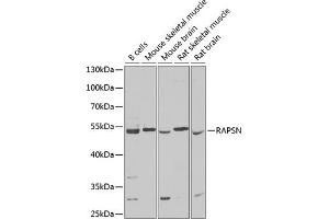 Western blot analysis of extracts of various cell lines, using RAPSN Antibody (ABIN6132583, ABIN6146690, ABIN6146691 and ABIN6222434) at 1:1000 dilution. (RAPSN Antikörper  (AA 1-353))