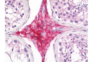 Immunohistochemistry (IHC) image for anti-Transforming Growth Factor, beta Receptor III (TGFBR3) (Extracellular Domain) antibody (ABIN2617545)