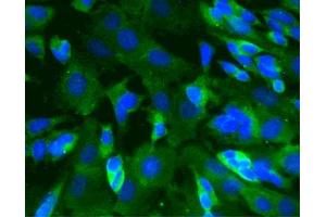 Immunofluorescence staining of SK-N-SH cells (Human neuroblastoma, ATCC HTB-11) (Second Panel). (CAMK2A Antikörper  (AA 448-460))