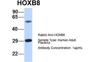 Host: Rabbit Target Name: HOXB8 Sample Type: Human Adult Placenta Antibody Dilution: 1. (HOXB8 Antikörper  (N-Term))