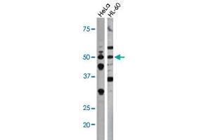 The CDC25A (phospho S75) polyclonal antibody  is used in Western blot to detect Phospho-CDC25A-S75 in Hela (left) and HL-60 (right) cell lysates.