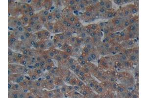 DAB staining on IHC-P; Samples: Human Liver Tissue (Laminin alpha 1 Antikörper  (AA 2613-2746))